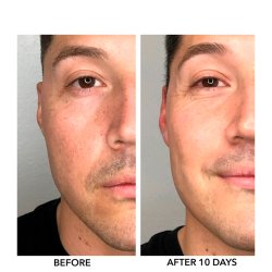 Algenist Genius Liquid Skin Resurfacing 2% BHA Toner 10 ml - Rejsestrrelse