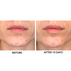 Algenist Genius Liquid Skin Resurfacing 2% BHA Toner 10 ml - Rejsestrrelse