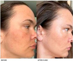 Algenist Blue Algae Vitamin C Dark Spot Correcting Peel 45 ml