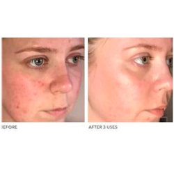 Algenist Blue Algae Vitamin C Dark Spot Correcting Peel 45 ml