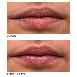 Algenist Genius Liquid Collagen LIP 15 ml