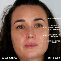 Plump It! No Needles Dermal Filler 15 stk x 0,67 ml