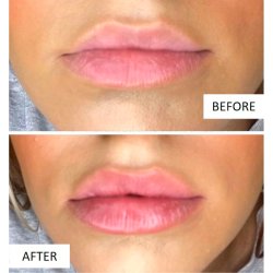 Plump It! Volumising Lip Plumper 3 ml