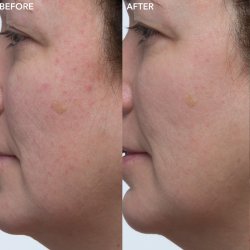 Algenist Green Microalgae Retinol+ Regenerating Serum 30 ml - INTROPRIS