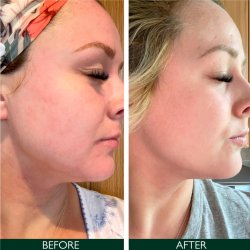 Sorted Skin Intensive Rescue Face Lotion 50 ml