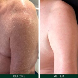 Sorted Skin Intensive Rescue Moisturiser 100 ml