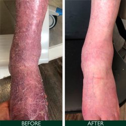 Sorted Skin Intensive Rescue Moisturiser 100 ml