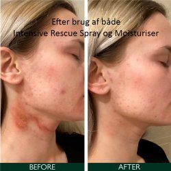 Sorted Skin Intensive Rescue Spray 100 ml