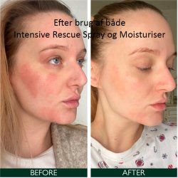 Sorted Skin Intensive Rescue Spray 100 ml