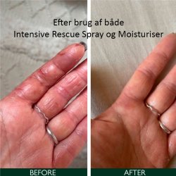 Sorted Skin Intensive Rescue Spray 100 ml