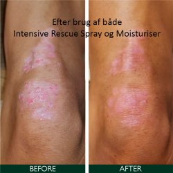 Sorted Skin Intensive Rescue Spray 100 ml