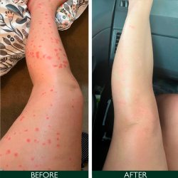 Sorted Skin Intensive Rescue Spray 100 ml