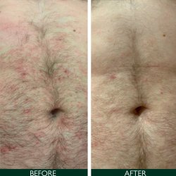 Sorted Skin Intensive Rescue Spray 100 ml