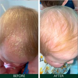 Sorted Skin Intensive Rescue Spray 100 ml